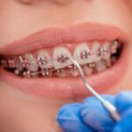 Orthodontics