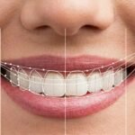 Digital Smile Design