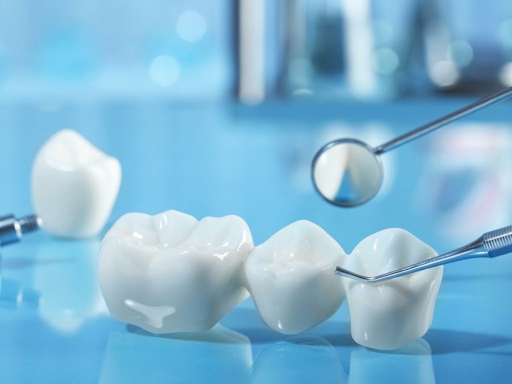 No Push Toward Implants